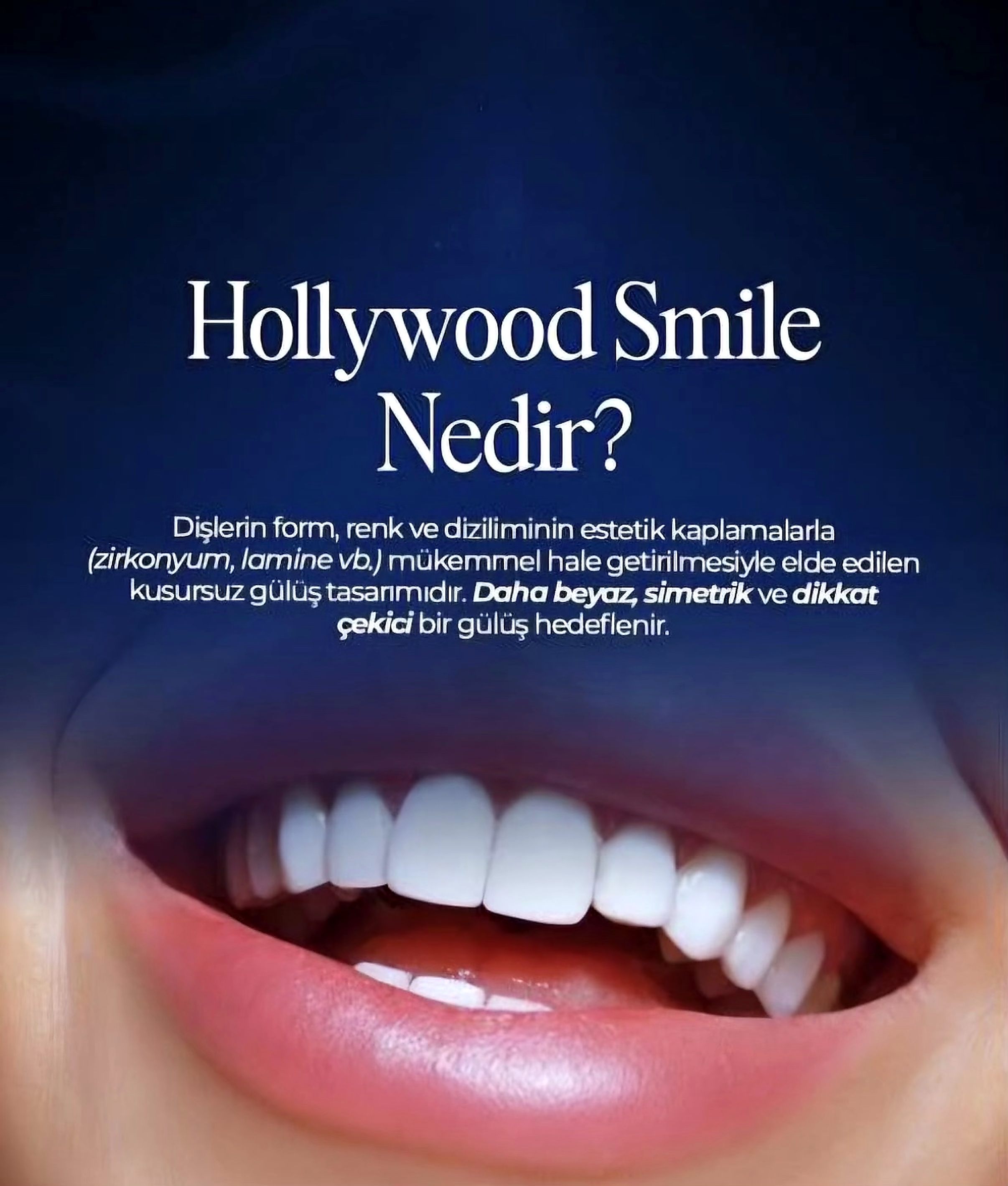 Instagram gönderisi 2