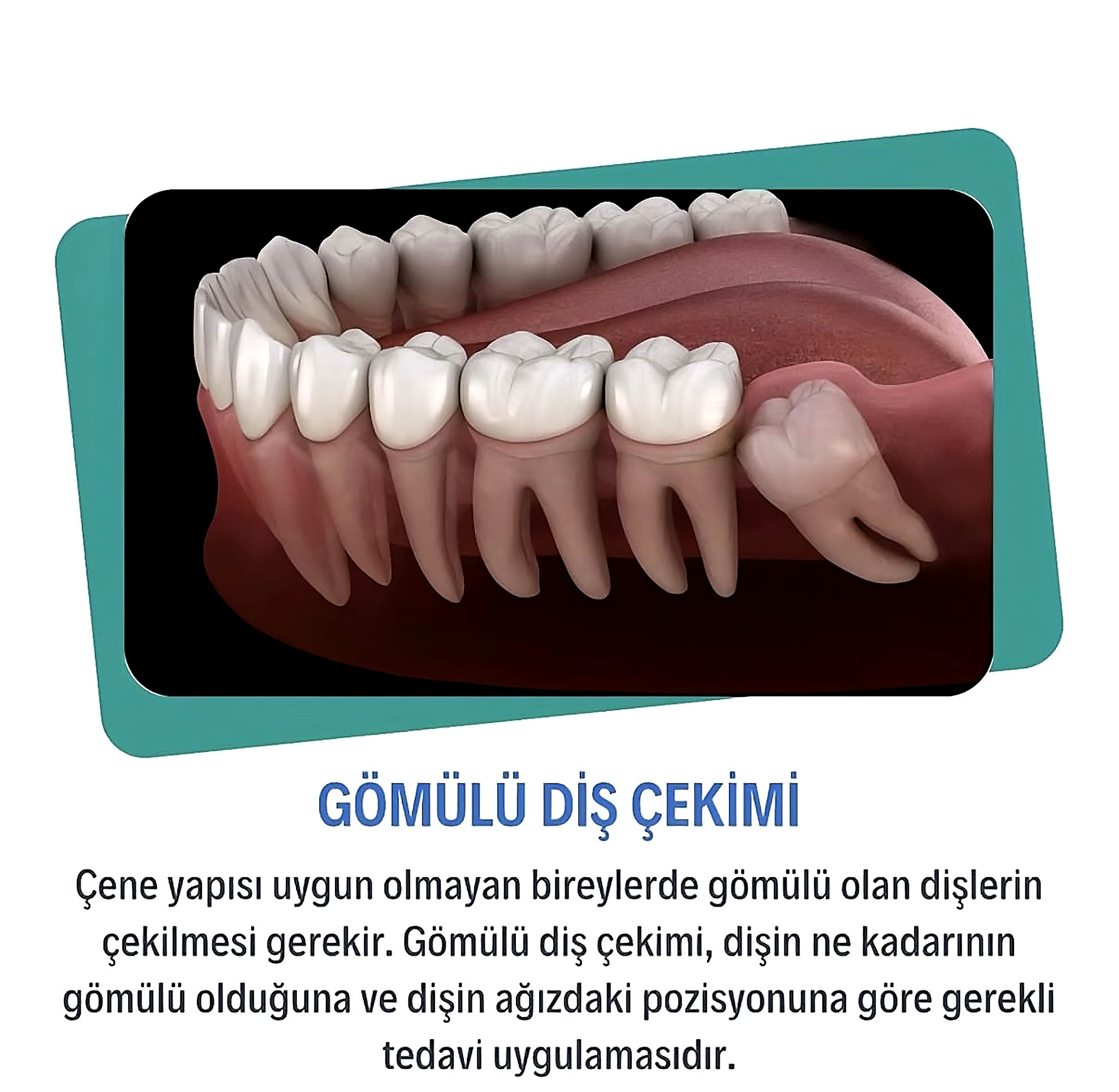 Instagram gönderisi 3